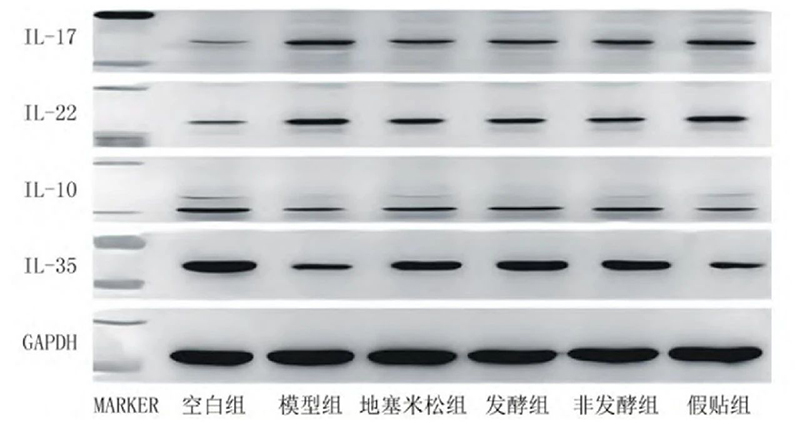 空白組和支氣管哮喘各組大鼠肺組織中IL－17、IL－22、IL－10、IL－35蛋白表達(dá)電泳圖